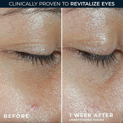 RoC Multi Correxion Revive + Glow Eye Balm with Vitamin C (0.14 oz) + Retinol Eye Cream Packette
